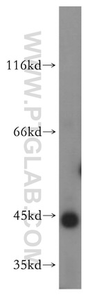 GTF2H2C Antibody in Western Blot (WB)