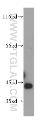 GTF2H2C Antibody in Western Blot (WB)