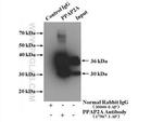 PPAP2A Antibody in Immunoprecipitation (IP)