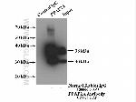 PPAP2A Antibody in Western Blot (WB)