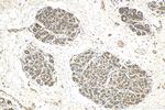 uPA Antibody in Immunohistochemistry (Paraffin) (IHC (P))
