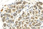 uPA Antibody in Immunohistochemistry (Paraffin) (IHC (P))