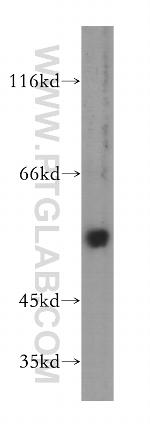 uPA Antibody in Western Blot (WB)