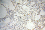 uPA Antibody in Immunohistochemistry (Paraffin) (IHC (P))