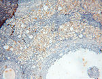 uPA Antibody in Immunohistochemistry (Paraffin) (IHC (P))