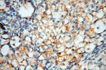 uPA Antibody in Immunohistochemistry (Paraffin) (IHC (P))
