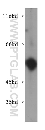 uPA Antibody in Western Blot (WB)