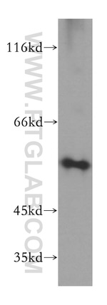 uPA Antibody in Western Blot (WB)