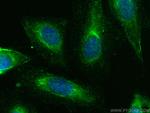 MYO1C Antibody in Immunocytochemistry (ICC/IF)