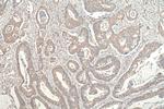 MYO1C Antibody in Immunohistochemistry (Paraffin) (IHC (P))