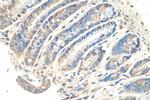 MYO1C Antibody in Immunohistochemistry (Paraffin) (IHC (P))