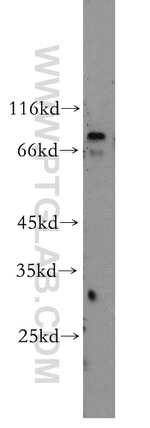 RGS9 Antibody in Western Blot (WB)