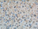 Cannabinoid receptor 1 Antibody in Immunohistochemistry (Paraffin) (IHC (P))