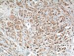PRKAR1B Antibody in Immunohistochemistry (Paraffin) (IHC (P))