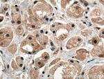 PRKAR1B Antibody in Immunohistochemistry (Paraffin) (IHC (P))