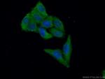 RBMX2 Antibody in Immunocytochemistry (ICC/IF)