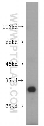 RBMX2 Antibody in Western Blot (WB)
