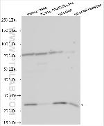 ADH1A Antibody in Western Blot (WB)