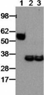 Goat anti-Rat IgG (H+L) Secondary Antibody, HRP, eBioscience™