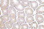 MAGEB3 Antibody in Immunohistochemistry (Paraffin) (IHC (P))