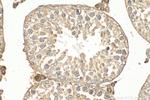MAGEB3 Antibody in Immunohistochemistry (Paraffin) (IHC (P))