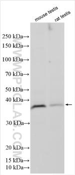MAGEB3 Antibody in Western Blot (WB)