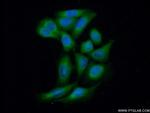 PP11 Antibody in Immunocytochemistry (ICC/IF)
