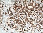 PP11 Antibody in Immunohistochemistry (Paraffin) (IHC (P))