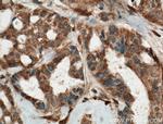 PP11 Antibody in Immunohistochemistry (Paraffin) (IHC (P))