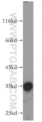 PP11 Antibody in Western Blot (WB)
