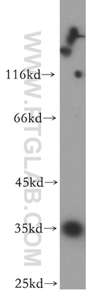 PP11 Antibody in Western Blot (WB)
