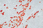 Hepatitis B Surface Antigen / HbsAg Antibody in Immunohistochemistry (IHC)