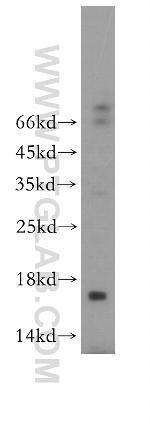 CREBL2 Antibody in Western Blot (WB)