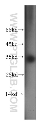 EIF2B1 Antibody in Western Blot (WB)