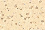EIF2B1 Antibody in Immunohistochemistry (Paraffin) (IHC (P))