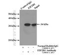 EIF2B1 Antibody in Immunoprecipitation (IP)
