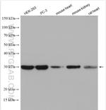 ATPAF1 Antibody in Western Blot (WB)