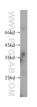 ATPAF1 Antibody in Western Blot (WB)