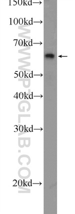 PLAG1 Antibody in Western Blot (WB)