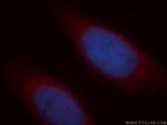 ICA1L Antibody in Immunocytochemistry (ICC/IF)