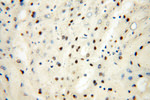 SART3 Antibody in Immunohistochemistry (Paraffin) (IHC (P))
