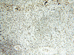 SART3 Antibody in Immunohistochemistry (Paraffin) (IHC (P))