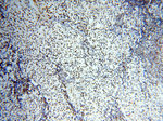 SART3 Antibody in Immunohistochemistry (Paraffin) (IHC (P))