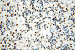 SART3 Antibody in Immunohistochemistry (Paraffin) (IHC (P))