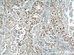 SART3 Antibody in Immunohistochemistry (Paraffin) (IHC (P))