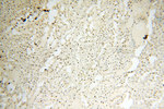 SART3 Antibody in Immunohistochemistry (Paraffin) (IHC (P))