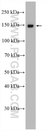 SART3 Antibody in Western Blot (WB)