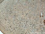 STYK1 Antibody in Immunohistochemistry (Paraffin) (IHC (P))