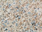 STYK1 Antibody in Immunohistochemistry (Paraffin) (IHC (P))