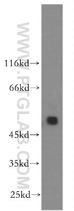 STYK1 Antibody in Western Blot (WB)
